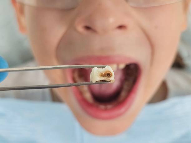 Best Tooth Infection Emergency Dentist  in Midway, UT